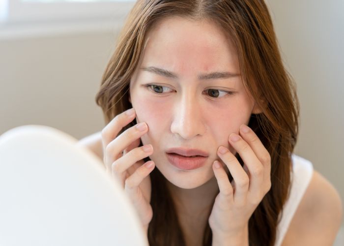 Da mặt mỏng có nên tẩy tế bào chết không?