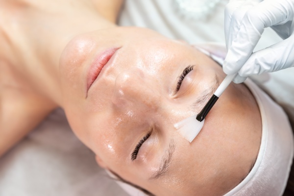 |Giải đáp| Sau khi peel da có nên rửa mặt không? Cách skincare đúng cách sau peel da!
