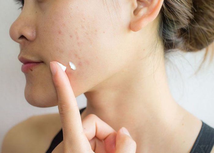 Cách dùng kem dưỡng ẩm