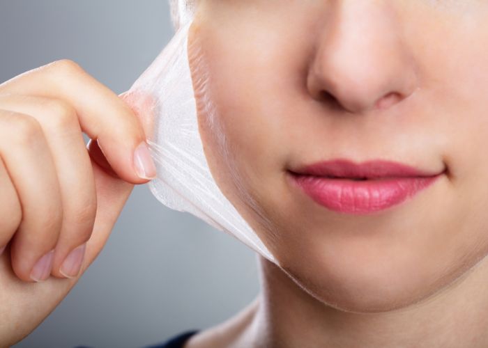 Hướng Dẫn Cách Đắp Mặt Nạ Đúng Sau Khi Peel Da
