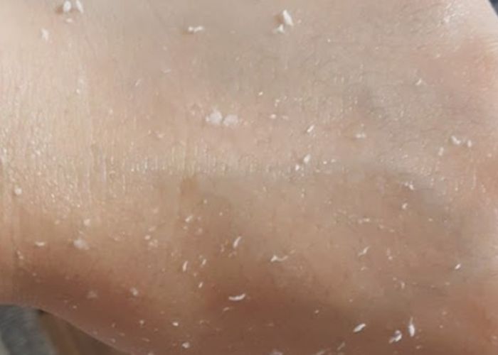 Tiêu chí chọn tẩy da chết cho da dầu