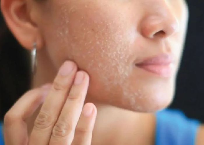 Tầm quan trọng của việc chọn sữa rửa mặt phù hợp cho da khô 