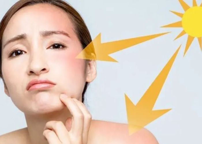 Những sai lầm khi chọn và sử dụng kem chống nắng cho da dầu