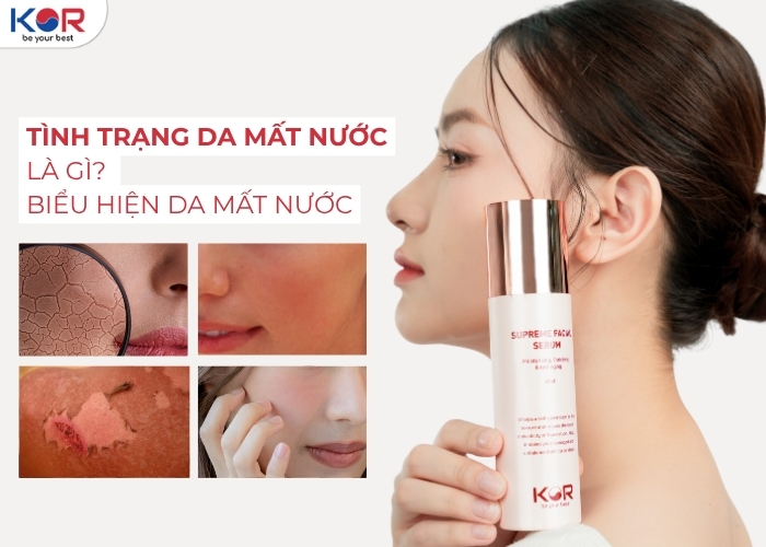 Đừng để nắng hè phá huỷ làn da bạn – Dùng serum dưỡng ẩm cho da mất nước nào?