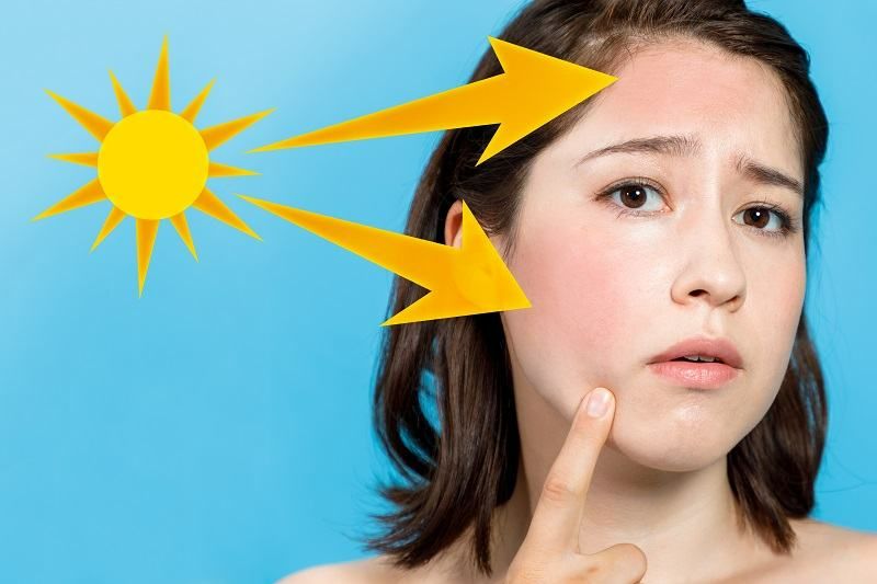 5 sai lầm khi đi biển làm cháy nắng da và lão hóa sớm: cẩm nang bảo vệ da từ a đến z