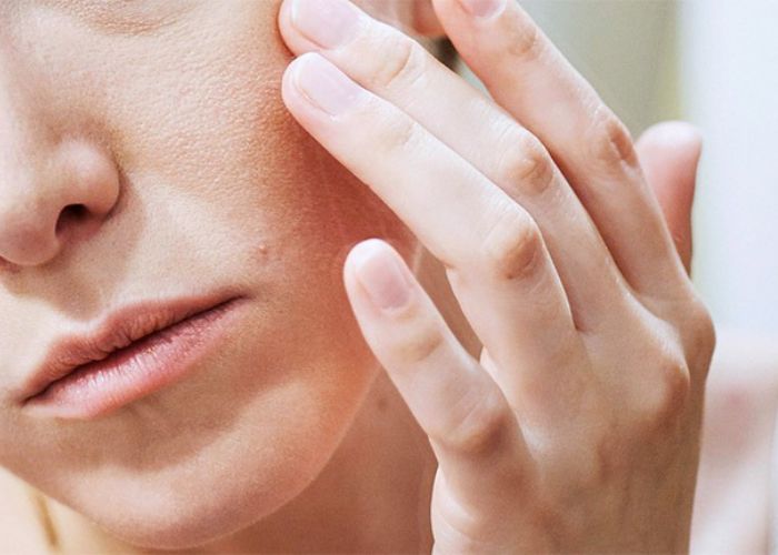 Tình trạng da khô do điều hòa