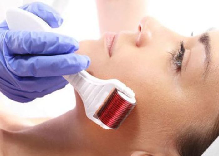 MTS Là Gì? Toàn Bộ Kiến Thức Về Công Nghệ Lăn Kim Tái Tạo Da Chuẩn Y Khoa