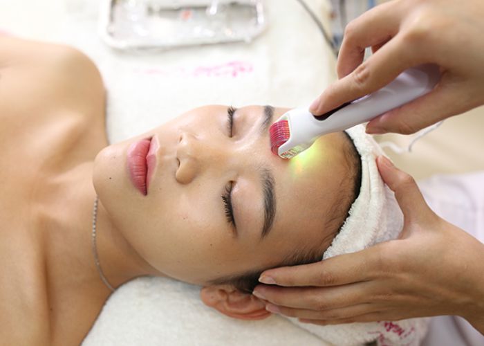 Lăn kim có thể gây cảm giác châm chích, hơi rát nhẹ