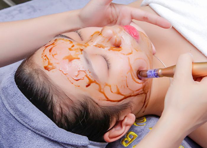 Ai Nên Thực Hiện Liệu Pháp Cấy Tinh Chất Nhau Thai