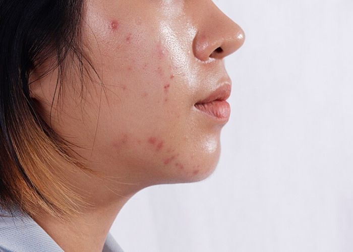 Da dầu nên uống nước ép gì