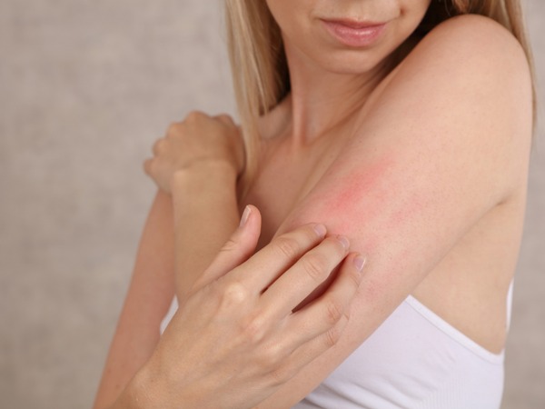 Which Body Lotion Is Best for Sensitive Skin? Top 7 Safe and Effective Choices