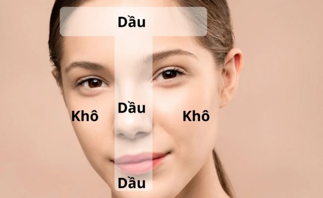 Da hỗn hợp thiên dầu là loại da sở hữu hai thái cực đối lập trên cùng một khuôn mặt.