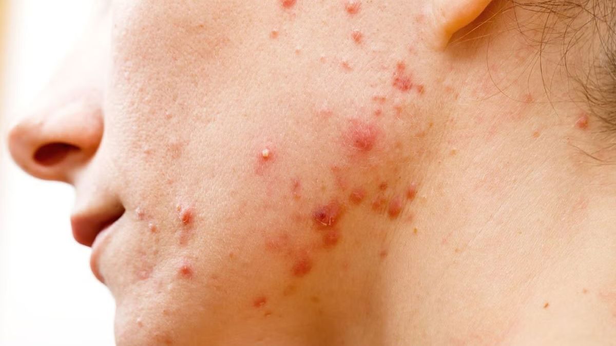 Những trường hợp cụ thể không nên thực hiện treatment