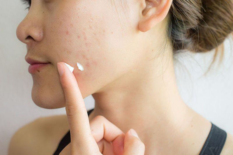 Zinc có phù hợp với mọi loại da không