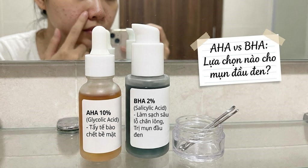 Mụn đầu đen: Dùng BHA được không? AHA có trị không?