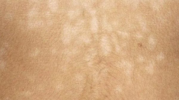 Câu hỏi thường gặp