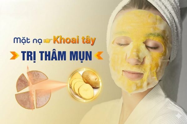 Đắp mặt nạ khoai tây trị thâm nguyên chất