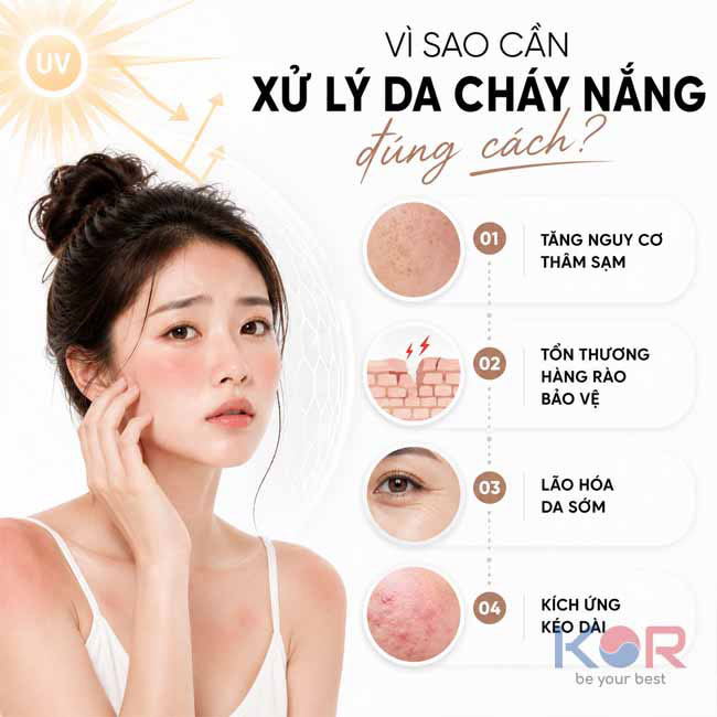 Vì sao cần xử lý da cháy nắng đúng cách?