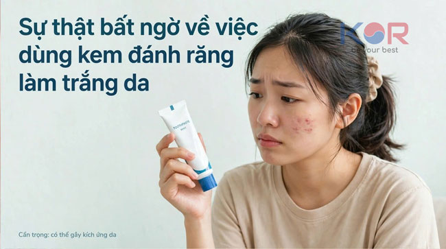 Sự thật bất ngờ về việc dùng kem đánh răng làm trắng da: Cẩn thận “tiền mất tật mang”!
